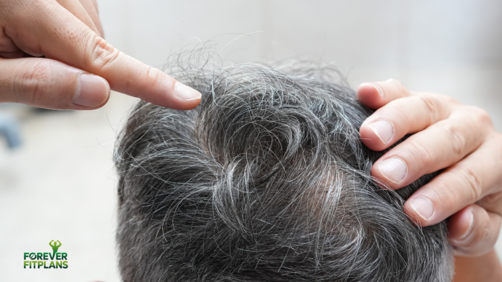 Which Vitamin Deficiency Causes Hair Loss